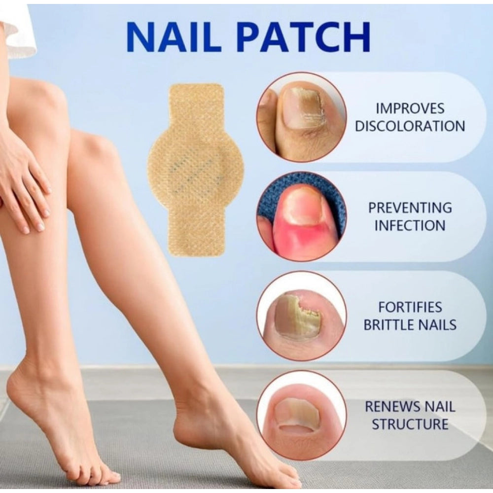 Fungal Nail Patches - Yellow