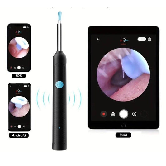 Earwax Cleaner With Camera - Multicolor